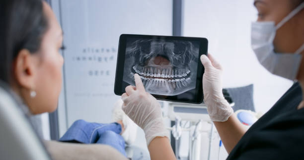 Licensed Wisdom Tooth Removal service in Galax, VA - Smile Center Dentistry